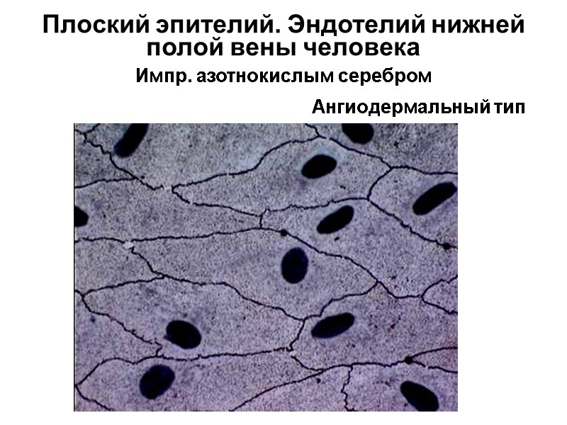 Плоский эпителий. Эндотелий нижней полой вены человека  Импр. азотнокислым серебром  Ангиодермальный тип